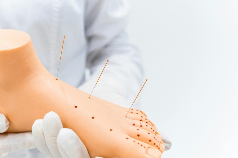Model of a foot with acupuncture needles illustrating alternative treatment methods.